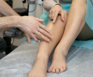 Лечение варикоза: современные методы и рекомендации